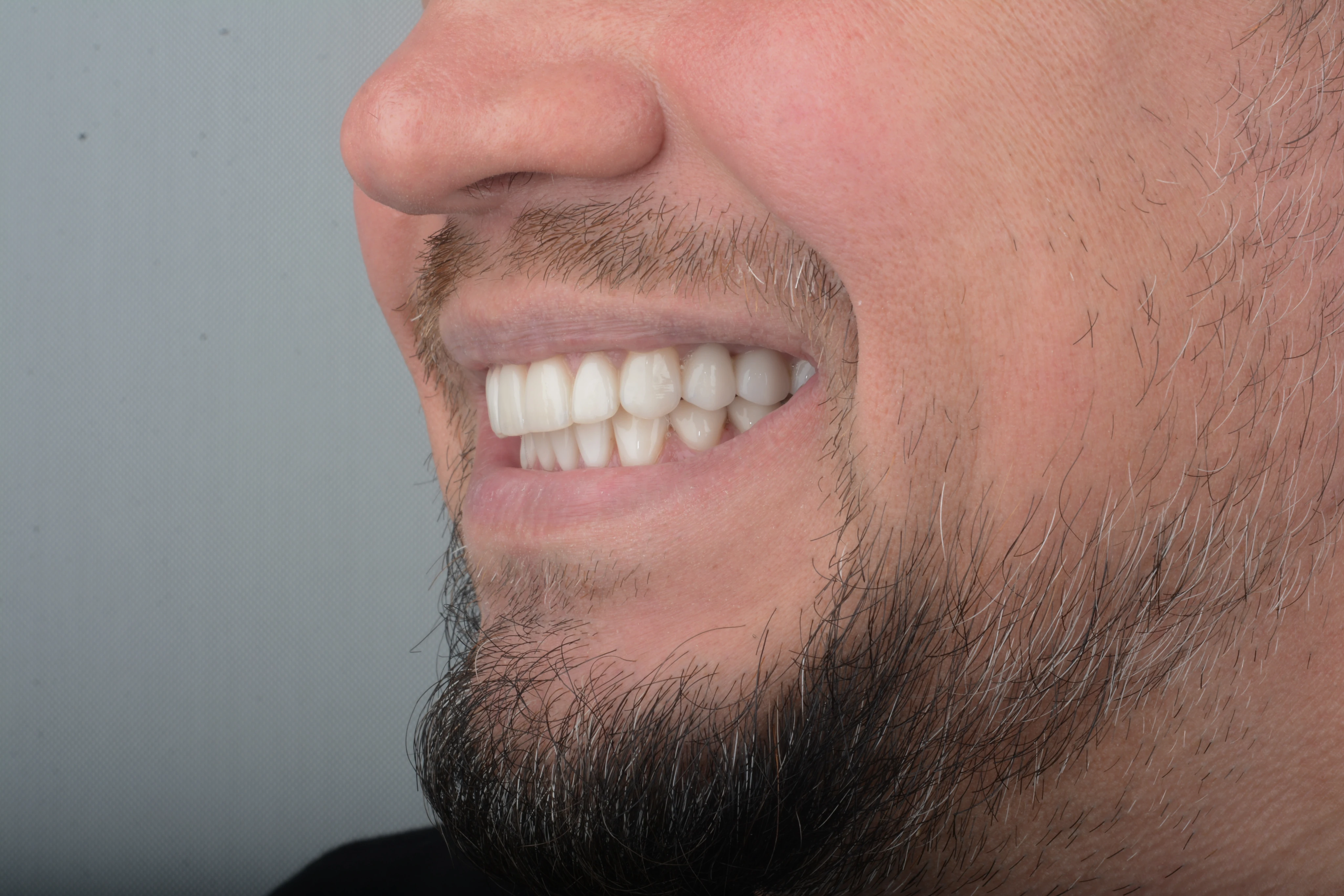 Имплантация и протезирование