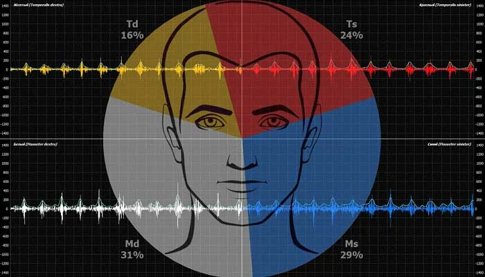 Электромиография
