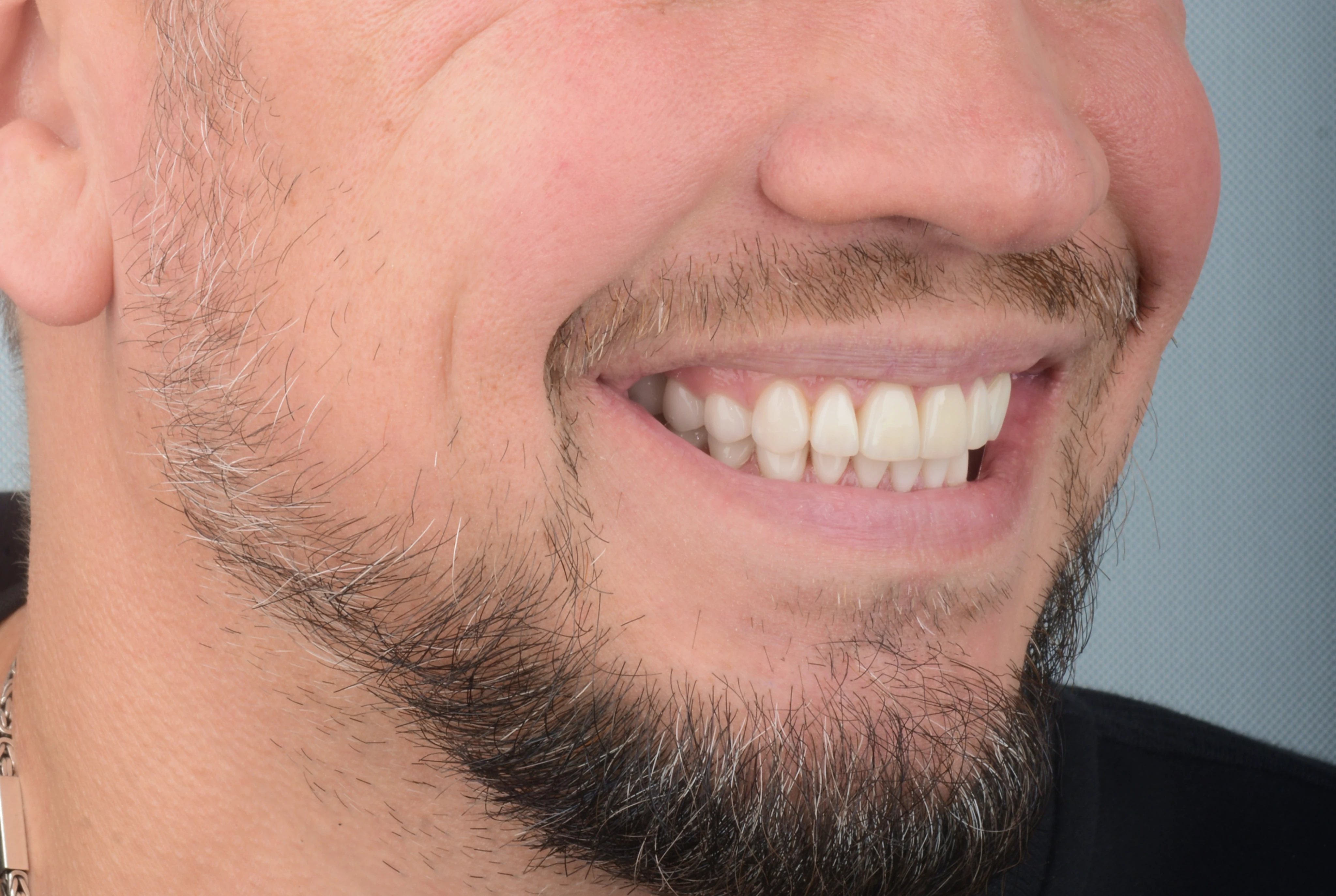 Имплантация и протезирование