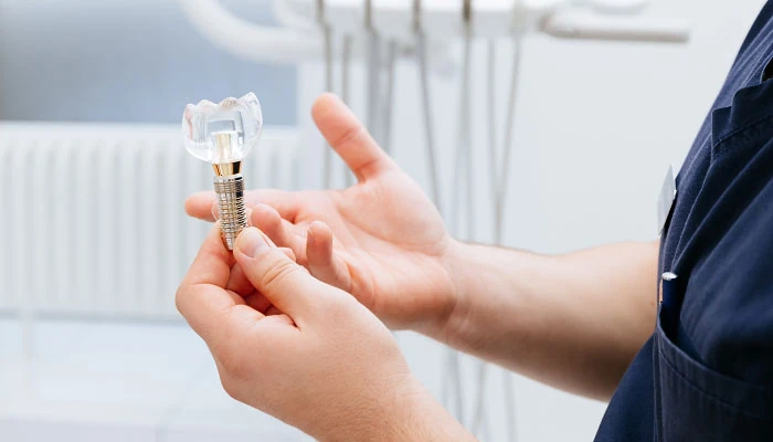 Имплантация зубов