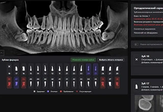 Искусственный интеллект Diagnocat