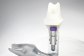 Экспресс имплантация зубов